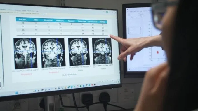 alzheimer-hastaligi-erken-teshis-edilebilecek-mi-8h9MlPb3.jpg