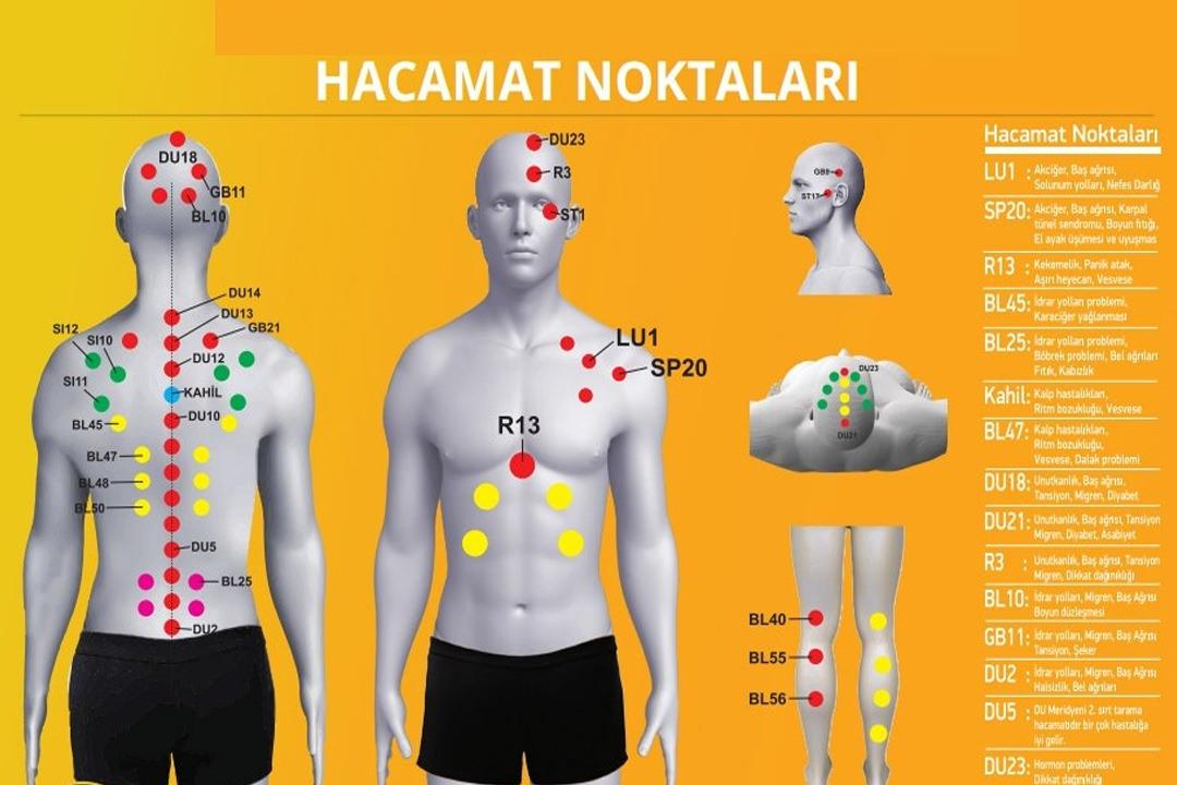 Hacamat Nasıl Yapılır?