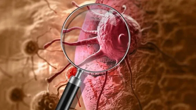 kanser-arastirmalarinda-fusobacterium-bakterisinin-carpici-etkileri-YkF6GaZF.jpg